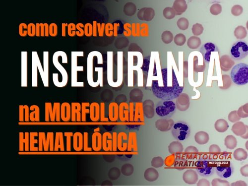 Descomplicando a Hematologia com a Metodologia 3R