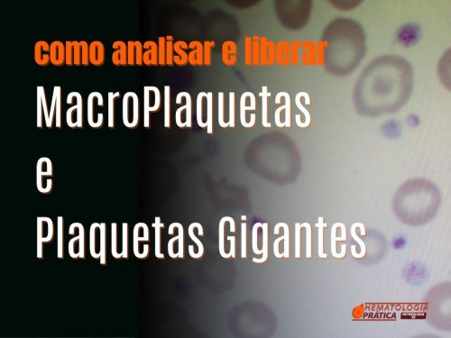 Macroplaquetas e Plaquetas Gigantes: Como Identific-las e Liber-las de Forma Padronizada