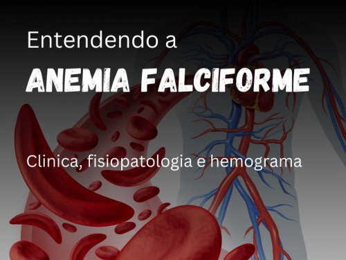 Anemia Falciforme: Entendendo a Doena que Transforma o Sangue em Desafios!