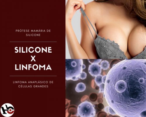Silicone X Linfoma